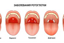 Photo of Эффективные способы борьбы с ангиной
