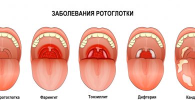 Photo of Эффективные способы борьбы с ангиной