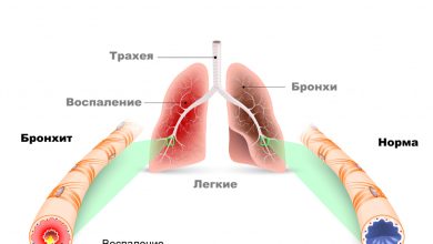 Photo of Лечение бронхита у взрослых