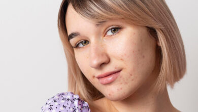 Photo of Эффективные средства от покраснений