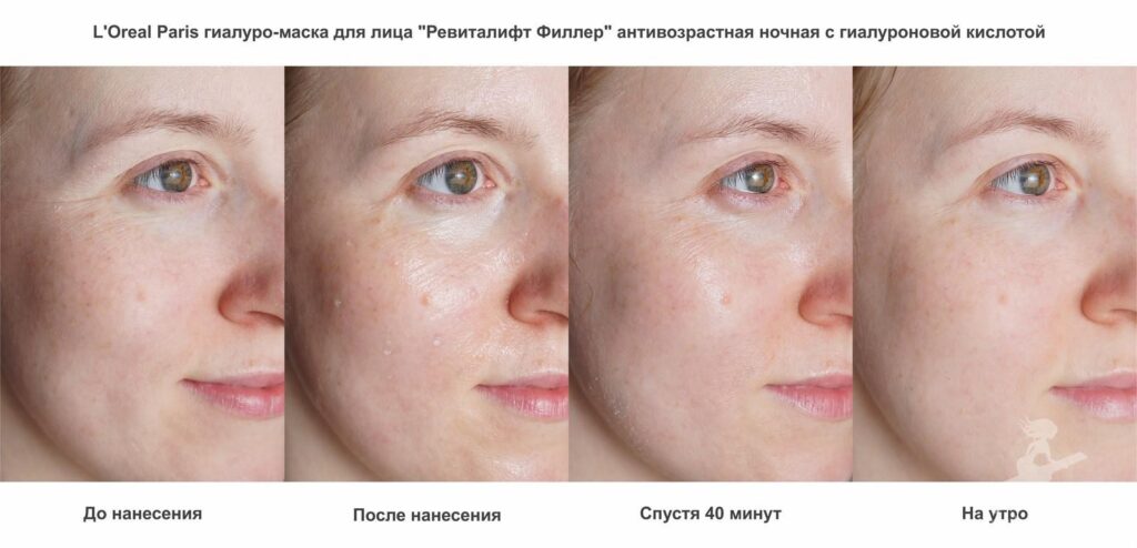 Фото 48 — Увлажнение и питание: гиалуроновая кислота