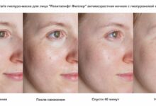 Photo of Увлажнение и питание: гиалуроновая кислота