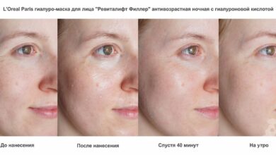 Photo of Увлажнение и питание: гиалуроновая кислота