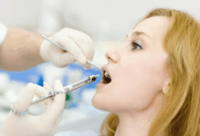 Photo of Плазмолифтинг для лица