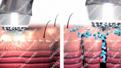 Photo of Электропорация кожи